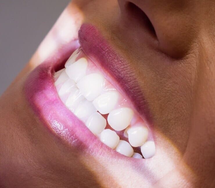 paciente femenino luz dandole en dientes