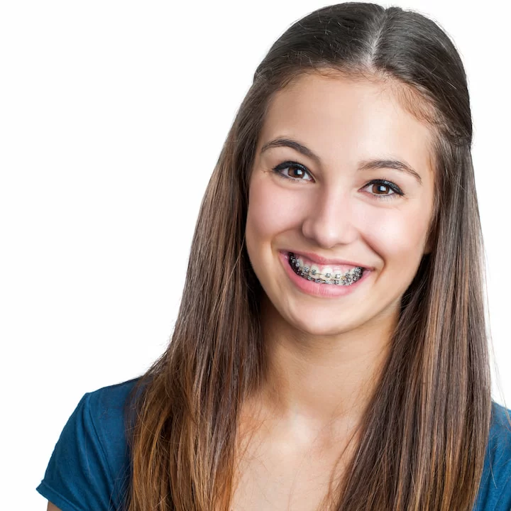chica joven sonriendo orodoncia fija