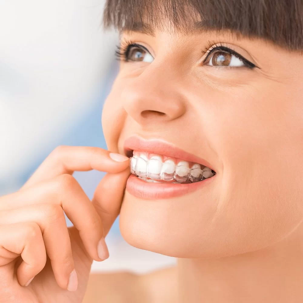 chica poniendose invisalign