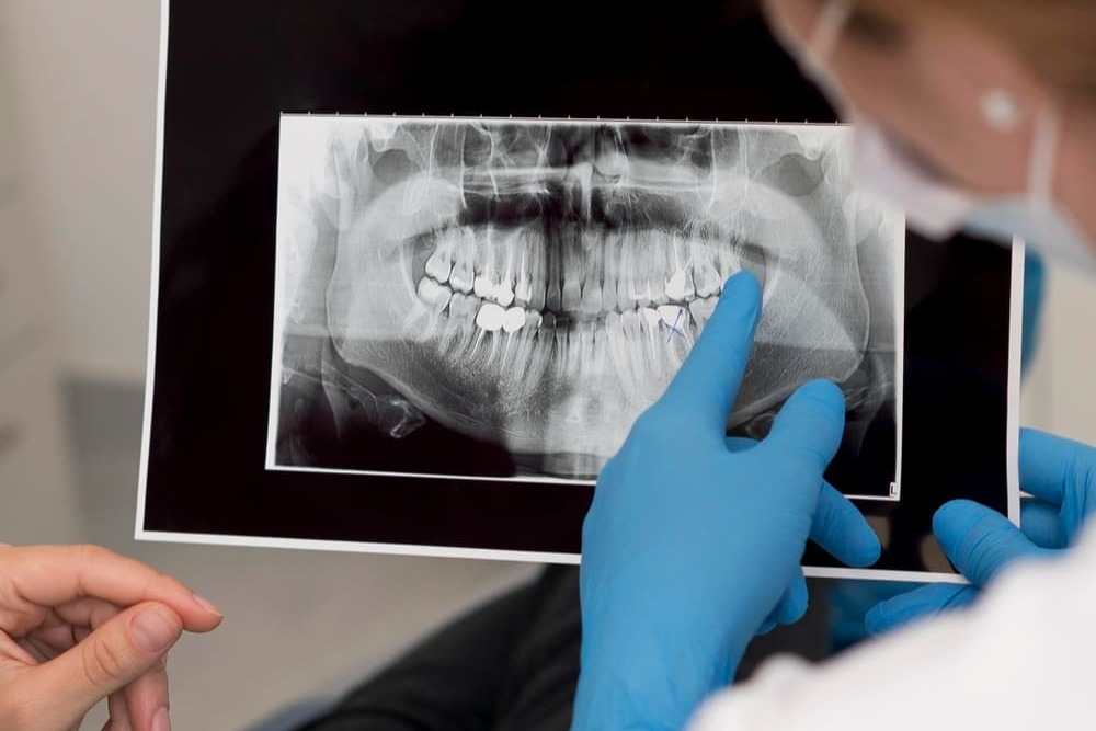 dentista mostrando radiografia dental paciente dentista mostrando radiografia dental paciente