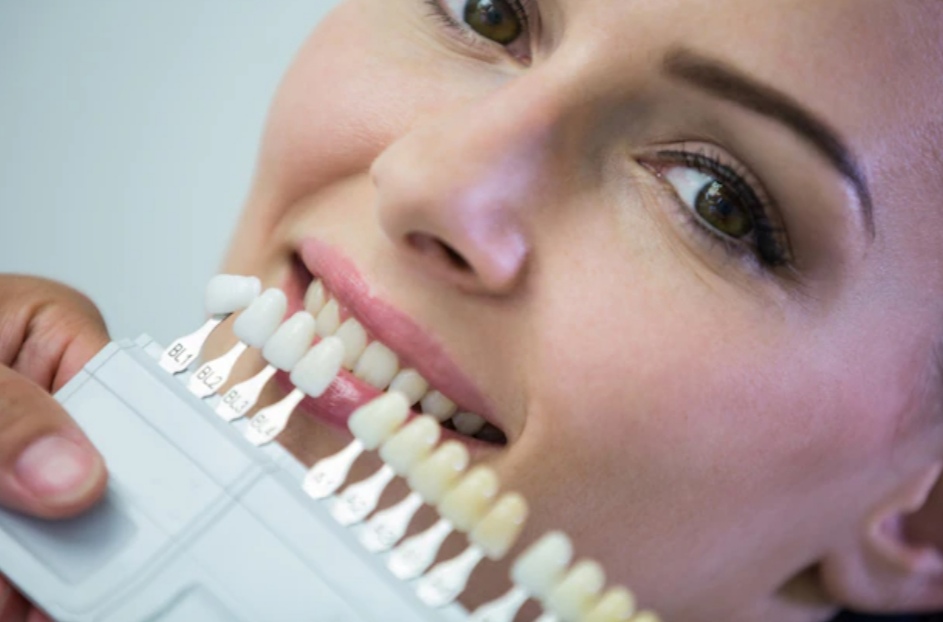 mujer probandose frente camara carillas dentales