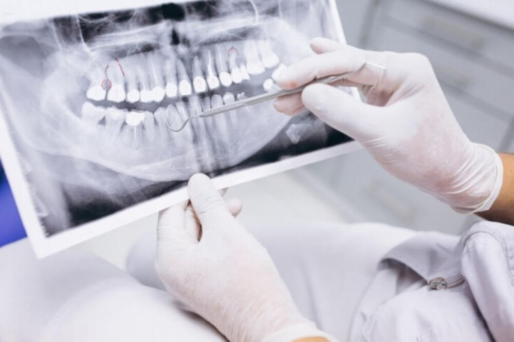 escaner digital para colocacion de implantes dentales