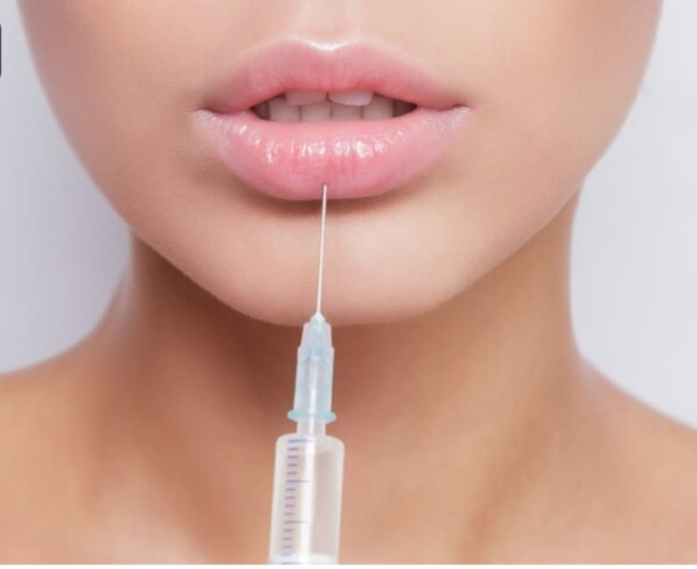 inyeccion estetica labios mujer procedimiento belleza cuidado facial